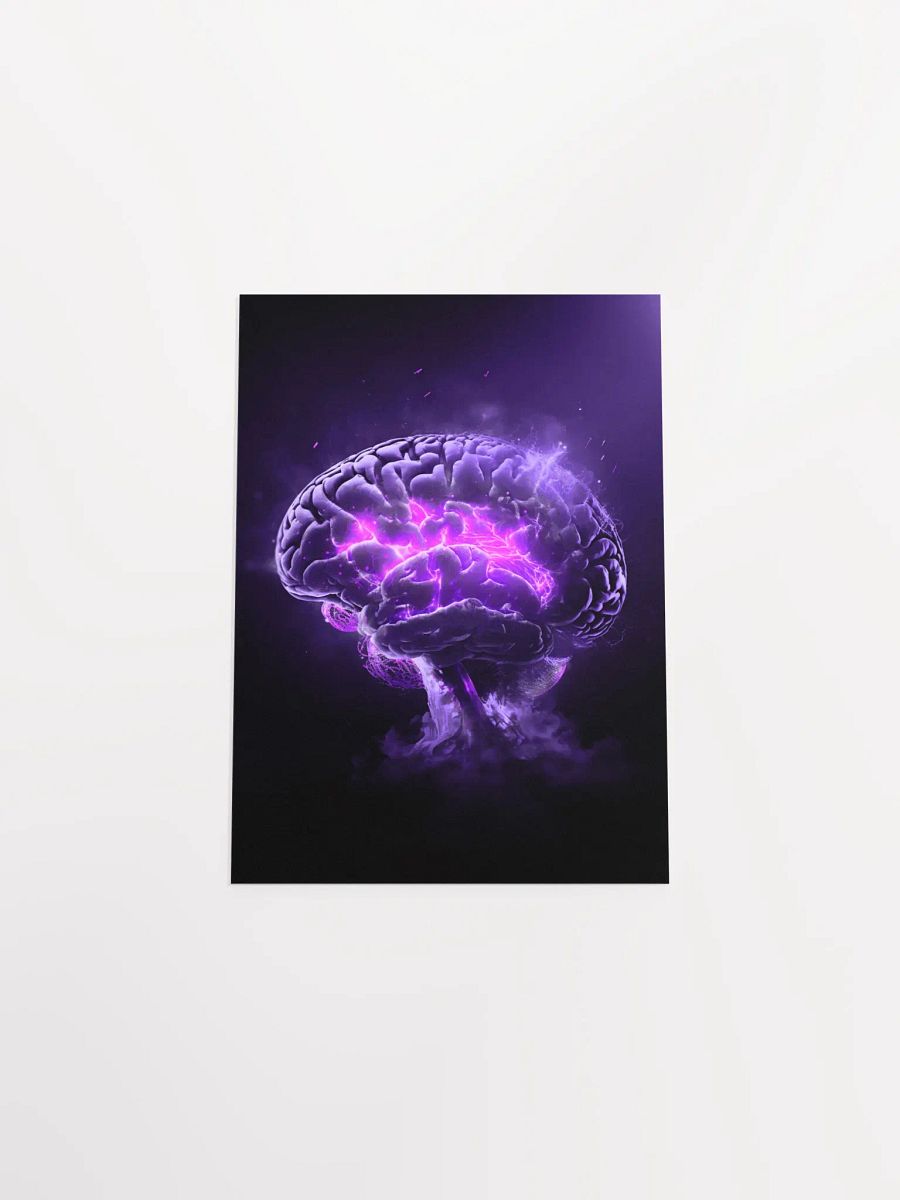 Remyelinating Brain (Matte Print) product image (52)