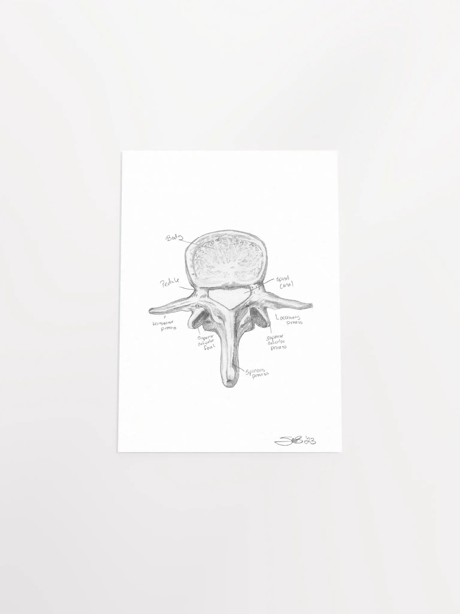 Lumbar Vertebrae Wall Art (Labeled) product image (7)