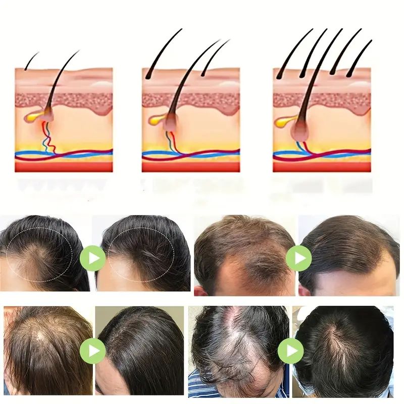 Miracle Hair Boost Drops product image (3)