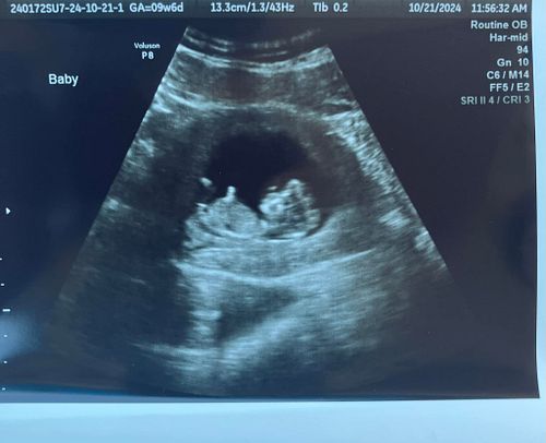 Look at my baby 😭