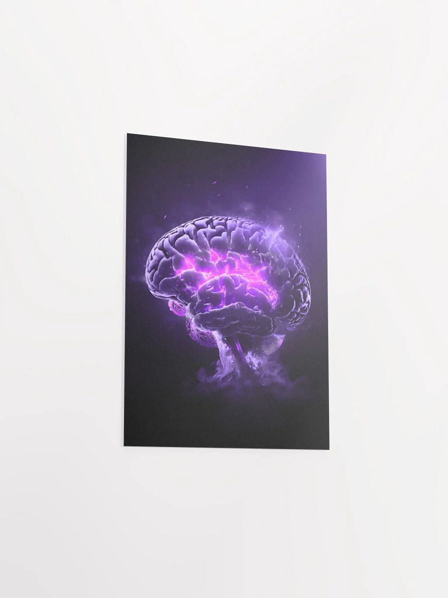 Remyelinating Brain (Matte Print) product image (37)