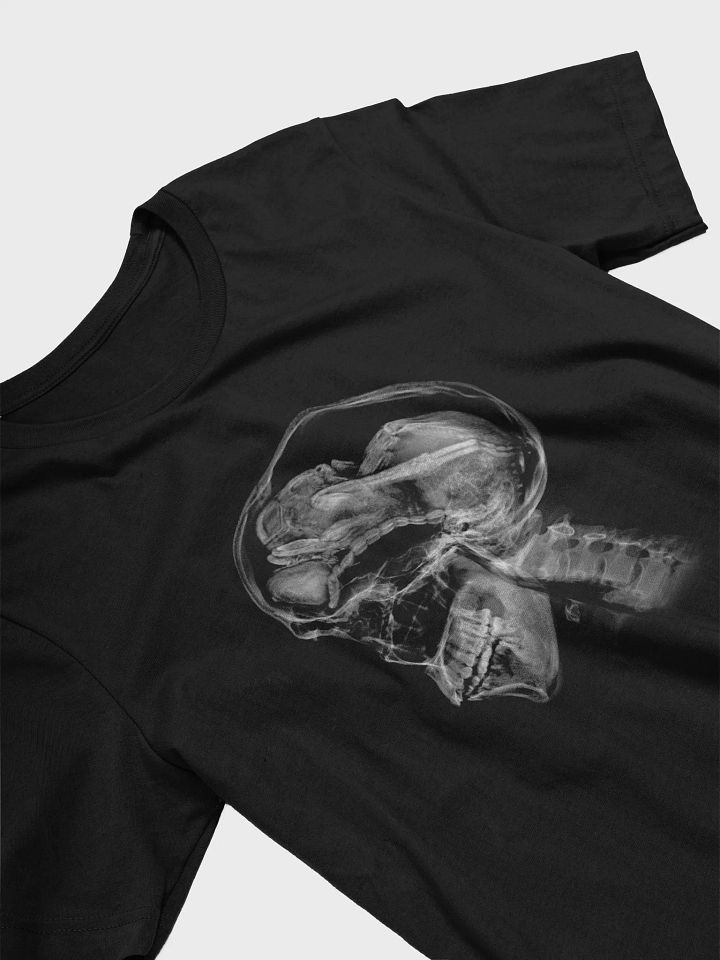 Parasitoid product image (2)