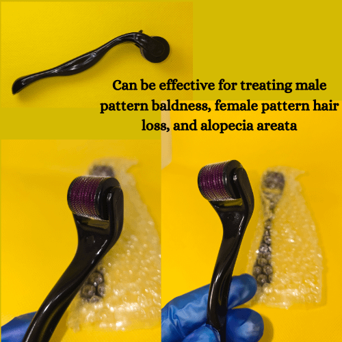 Derma Roller, Promote Hair Growth product image (4)