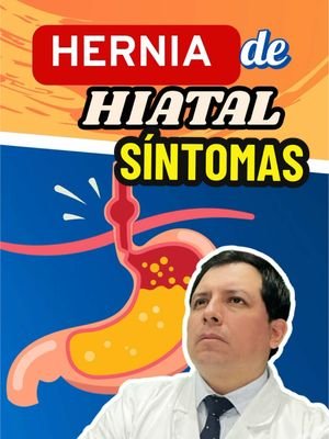 🩺 Hernia Hiatal: ¿Qué Es? Síntomas y Tratamiento 🍽️ Una hernia hiatal ocurre cuando una parte del estómago se desliza hacia arriba, a través del diafragma, hacia el tórax. El diafragma es el músculo que separa el pecho del abdomen, y una hernia hiatal interrumpe su función normal, permitiendo que una parte del estómago sobresalga hacia el pecho. Esta condición es común, especialmente en personas mayores de 50 años, y aunque muchas personas con hernia hiatal no experimentan síntomas graves, algunos pueden sufrir molestias o complicaciones que requieren tratamiento. Aquí te explicamos qué es, cuáles son los síntomas y qué opciones de tratamiento existen. 🔹 ¿Qué Es la Hernia Hiatal? 🩺 La hernia hiatal es una afección en la que una parte del estómago empuja hacia arriba a través del diafragma, en la zona conocida como el hiato esofágico, donde el esófago se conecta al estómago. Esta condición puede interferir con la función del esfínter esofágico inferior (EEI), que ayuda a prevenir el reflujo ácido del estómago hacia el esófago. 🔹 Síntomas Comunes 🚨 Acidez estomacal (pirosis) 🔥 El síntoma más frecuente de la hernia hiatal es la acidez estomacal o reflujo ácido, que ocurre cuando el ácido del estómago sube hacia el esófago, causando una sensación de ardor en el pecho. Dolor en el pecho 💥 La presión causada por el estómago que sobresale puede provocar dolor en el pecho que a veces se confunde con problemas cardíacos. Es importante diferenciarlo de un ataque al corazón. Dificultad para tragar 🥴 La disfagia o dificultad para tragar puede ocurrir debido a la obstrucción parcial del esófago por la hernia, lo que dificulta el paso normal de los alimentos. Regurgitación 🤢 Al igual que con el reflujo ácido, la regurgitación es cuando el contenido del estómago sube hacia la boca, lo que puede dejar un sabor amargo o ácido. Náuseas 🤢 Algunas personas con hernia hiatal pueden experimentar náuseas debido a la presión en el estómago. 🔹 Tratamiento de la Hernia Hiatal 💊 El tratamiento depende de la gravedad de los síntomas. Algunas opciones incluyen: Medicamentos 💊 Los medicamentos como los antiácidos, los inhibidores de la bomba de protones (IBP) y los bloqueadores H2 pueden ayudar a reducir el reflujo ácido y aliviar la acidez estomacal. Cambios en el estilo de vida 🏃‍♂️ Evitar comidas copiosas o grasosas. Comer en porciones más pequeñas y más frecuentes. No acostarse después de comer. Elevar la cabecera de la cama para evitar que el ácido suba mientras duermes. Cirugía 🏥 Si los medicamentos y los cambios en el estilo de vida no alivian los síntomas, se puede considerar la cirugía para corregir la hernia. El procedimiento más común es la fundoplicatura, en la que se refuerza el esfínter esofágico inferior para evitar el reflujo. 🥗 Consejo: Si experimentas síntomas como acidez persistente o dolor en el pecho, consulta a un médico para un diagnóstico adecuado. La hernia hiatal puede manejarse eficazmente con tratamiento y cambios en el estilo de vida. #HerniaHiatal #SaludDigestiva #Bienestar #CuidadoDeLaSalud #Prevención #dr_luispacora #luispacoracamargo #SaludDigestiva #LIVEIncentiveProgram #GoLIVEGrowFast #PaidPartnership 