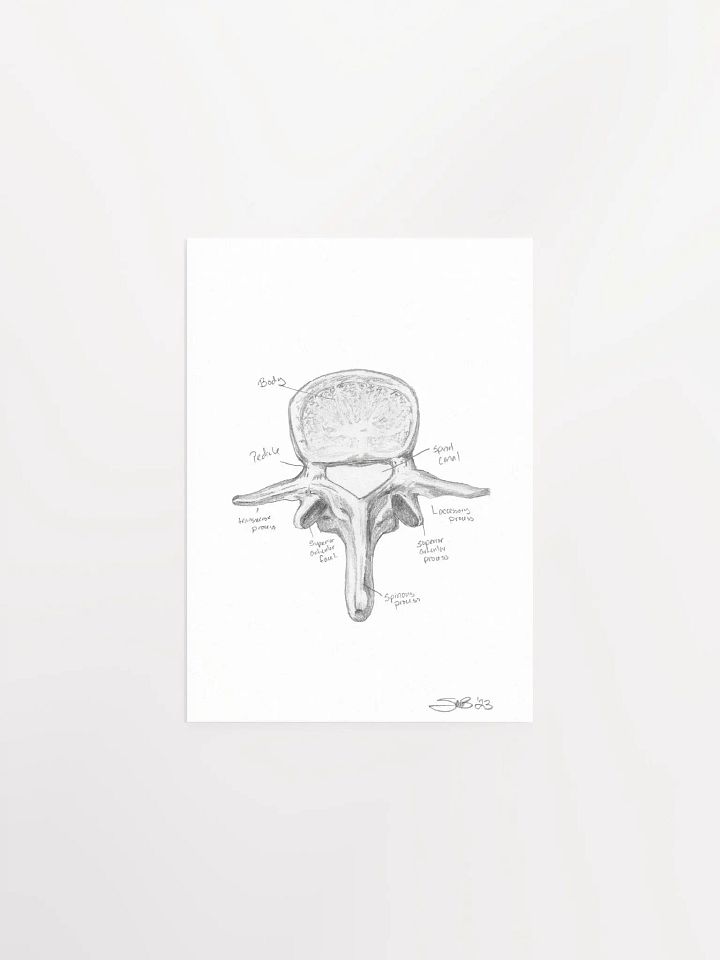 Lumbar Vertebrae Wall Art (Labeled) product image (2)