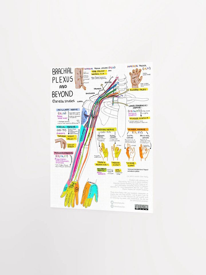 Brachial Plexus Poster product image (2)