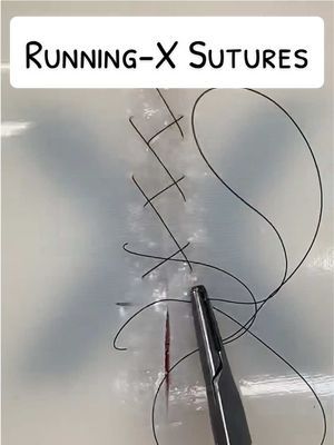 Running-X Sutures #1min #funfacts #learnontiktok #suture #suturing #stitches #surgery #surgeonsoftiktok #surgeontok #vet #veterinary #medicine #medicaltiktok #vetsoftiktok #veterinariansoftiktok #vetstudent #vetschool #doctor #doctorsoftiktok #medicalstudent #medicalschool #nurse #nursingstudent #nursingschool #vettechlife #vettechtok #vettechsoftiktok #vettech #lifehack #hack #greysanatomy