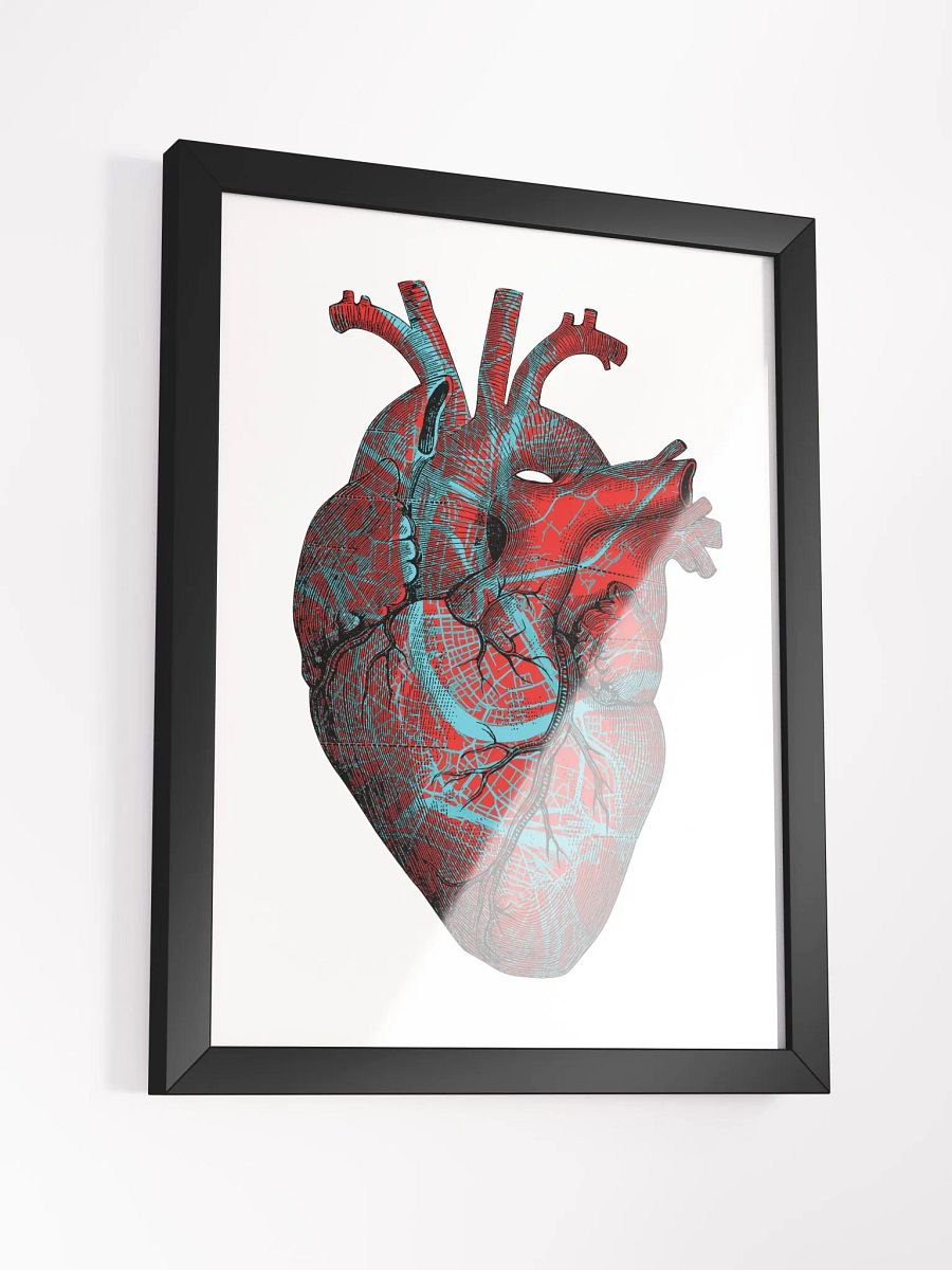 STREETHEART • framed Poster • collectors edition ⭐️⭐️⭐️⭐️⭐️ product image (15)