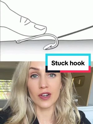 But don't let the fish know about this 🪝 (Also, if this happens to you please still go to a doctor for tetanus prophylaxis and possibly antibiotics!) #fishing #fishhook #firstaid #lifehack #safety #doctor #doctorreacts #doctorsoftiktok #learnsomethingnew #medical #surgery #medicalvideos #doctors #podiatry #podiatrist #footsurgeon #surgeon #surgeons #nurse #nurses #healthcare #scrublife #medicalhumor #scrubslife #podiatric #medicine 