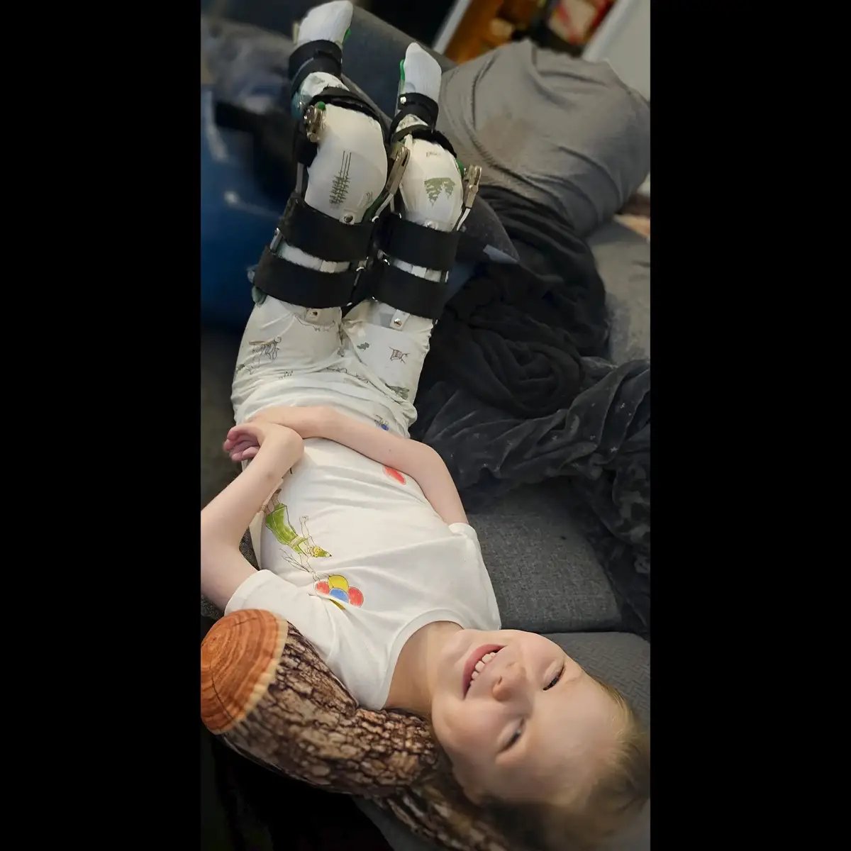 #somethingtothinkabout - Ana goes to bed almost every night with her legs forced into an 105° angle (flexion) for an hour and then they are straightened out and she sleeps in these KAFOs (knee-ankle-foot-orthotics) to keep her legs completely straight for the rest of the night.  She does this just so she can continue being able to walk and maintain the range of motion left from her major double leg surgery when she was three.  Ana was born with her arms stuck straight and her leg stuck bent. Because she was born with contractures on all of her joints in her arms and legs (including fingers and toes and everything) she has very little muscle tissue on her arms and legs. That's why her arms and legs are so skinny. Lack of muscle. Lack of muscle means lack of movement. Calcifications on the joints means lack of movement. Her body cannot be forced or manipulated into certain positions beyond a certain point because the calcifications are like bone and they just lock that joint in a certain position with a certain range.  Her wrists cannot go straight. Her elbows cannot go completely straight because she had two elbow releases so they would be able to bend (in order to be able to feed herself). Her legs cannot bend much more than 95° without the braces. It would be less if she didn't wear them and didn't do this stretching.  Arthrogryposis is a regressive condition. That means whatever corrections have been made with surgery and treatment and therapy over the course of the lifetime will always try to regress over time when allowed the opportunity. The bracing and stretching is to prevent regression. To maintain the range of motion we worked so hard to achieve.  #stillsmiling #arthrogryposis #teamamcana #DisabilityAwareness  #whatyoudontsee