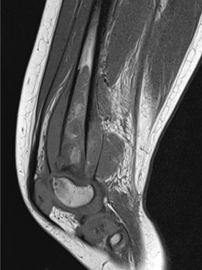 Imaging Diagnosis vs Gold Standard PQI Project product image (1)