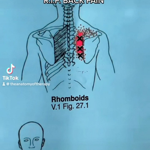 R.I.P. Rhomboid pain