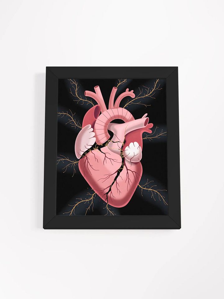 Cracked Heart Gold Veins Art | Emotional Support Symbolism Print product image (1)
