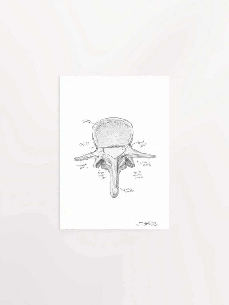 Lumbar Vertebrae Wall Art (Labeled)