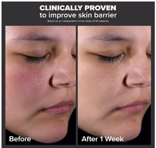 Paula's Choice SKIN PERFECTING 2% BHA Liquid Salicylic Acid Exfoliant product image (3)