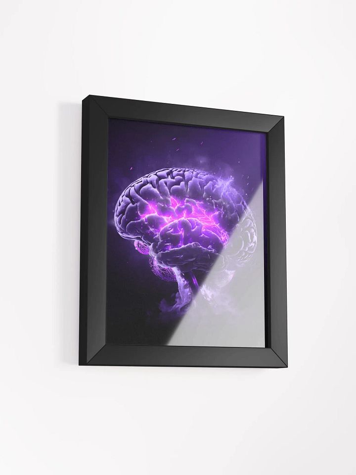 Remyelinating Brain (Framed Matte Print) product image (2)