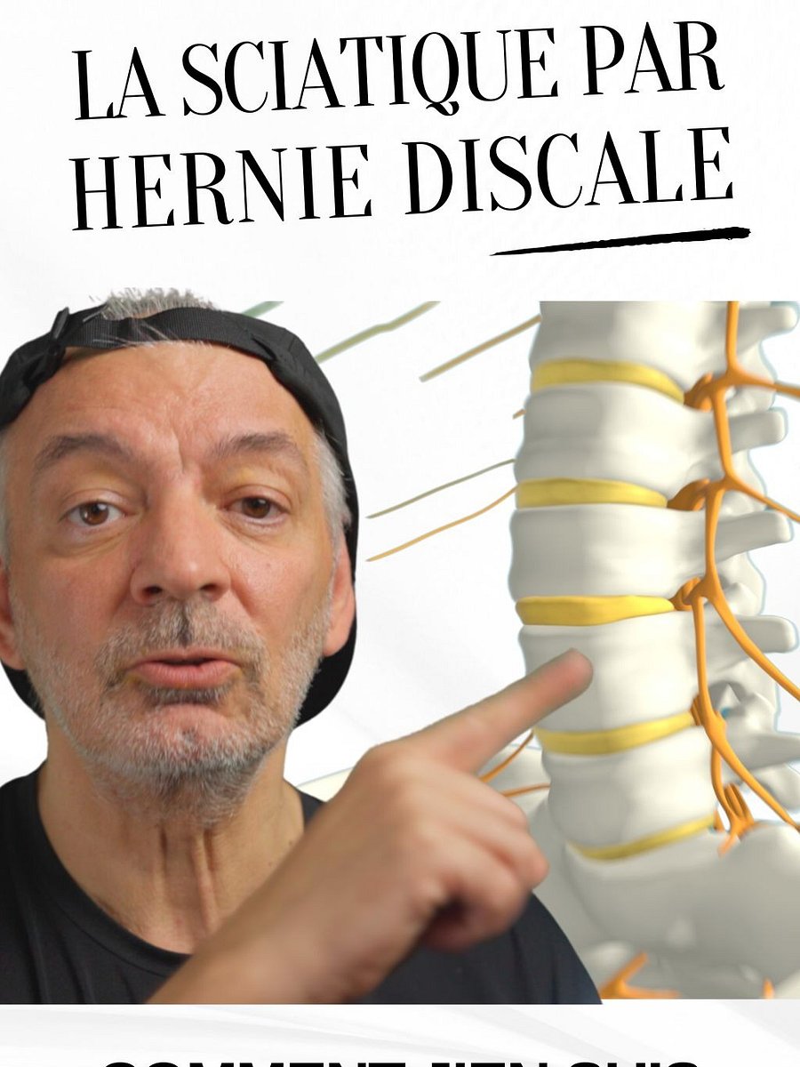 La Sciatique par hernie discale - Comment j'en suis venu à bout product image (1)