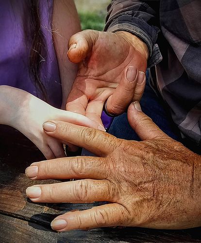 “Can’t they do anything to fix her hands?”
We get this question more often than you'd believe.

But here’s what people don’t ...