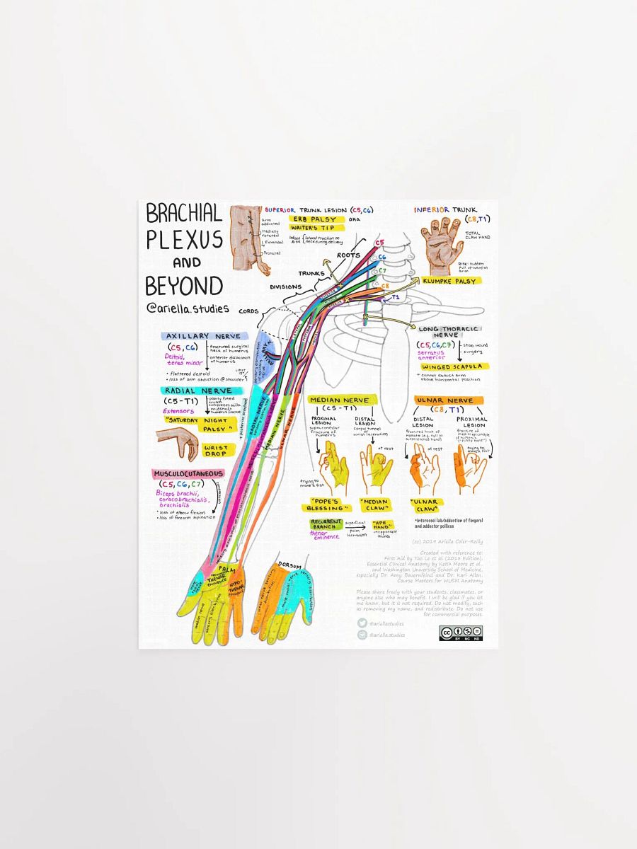 Brachial Plexus Poster product image (1)