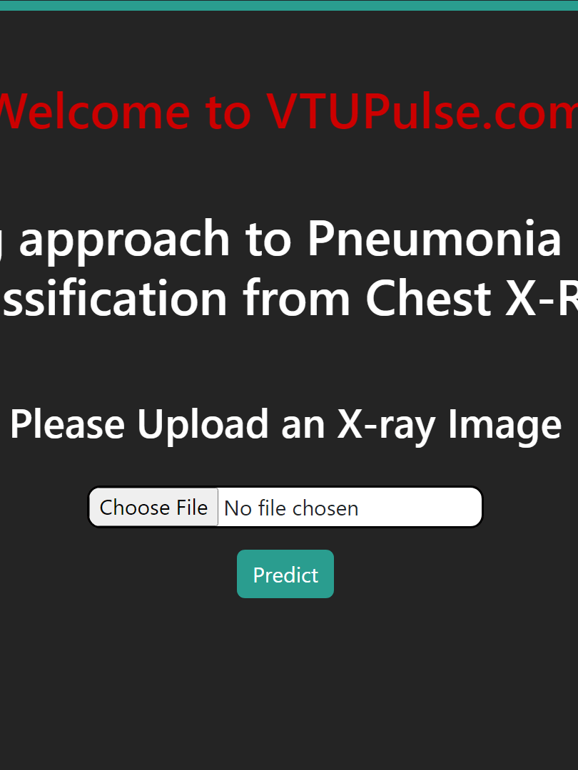 Pneumonia Detection from Chest X-Ray with Flask App Deep Learning Project product image (6)