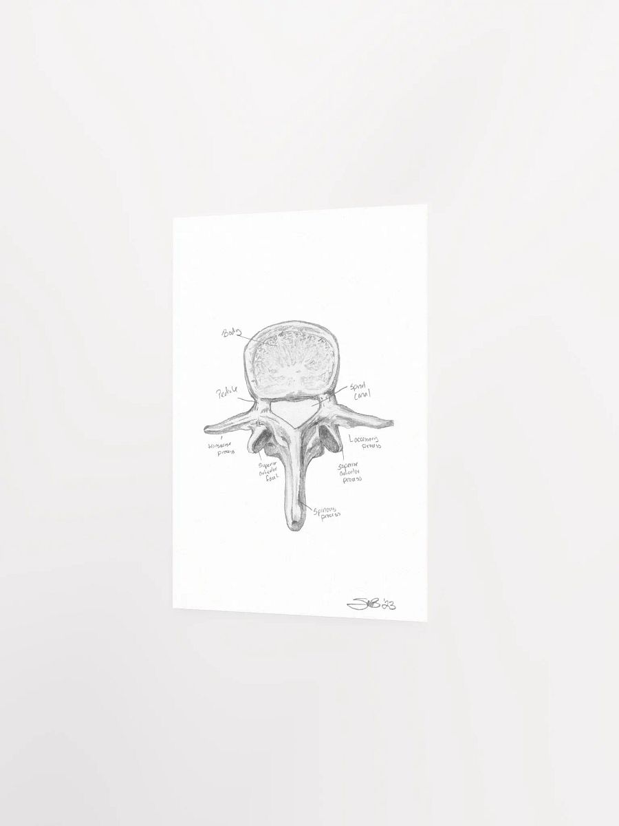 Lumbar Vertebrae Wall Art (Labeled) product image (3)