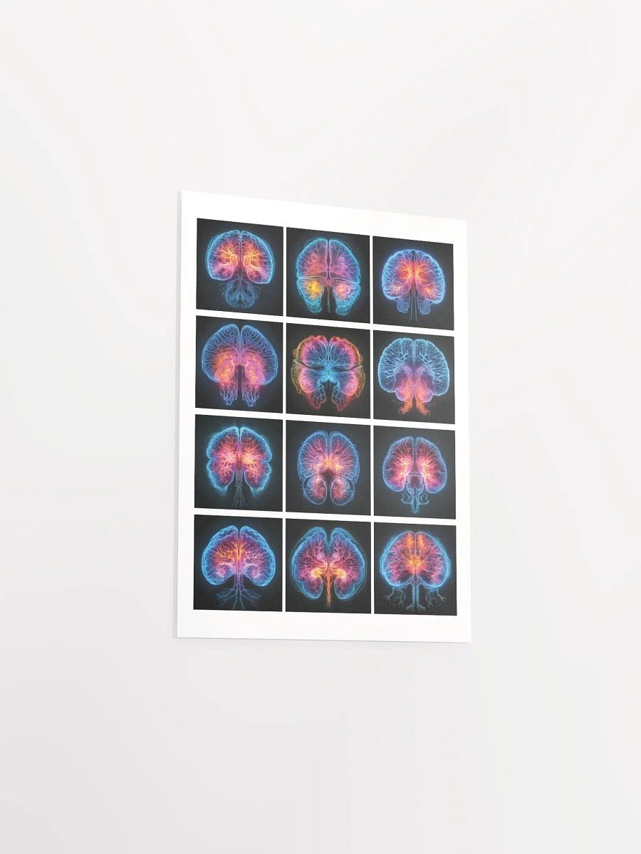 Brain Scan Matte Print product image (11)