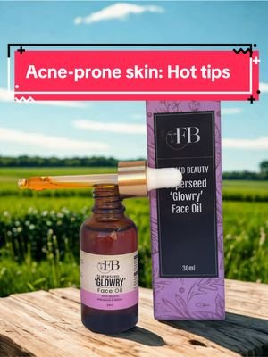 Acne prone skin can be difficult to manage but once you get it right, it’s easy to deal with… Which of the tips resonate with you? Comment below 👇🏽 