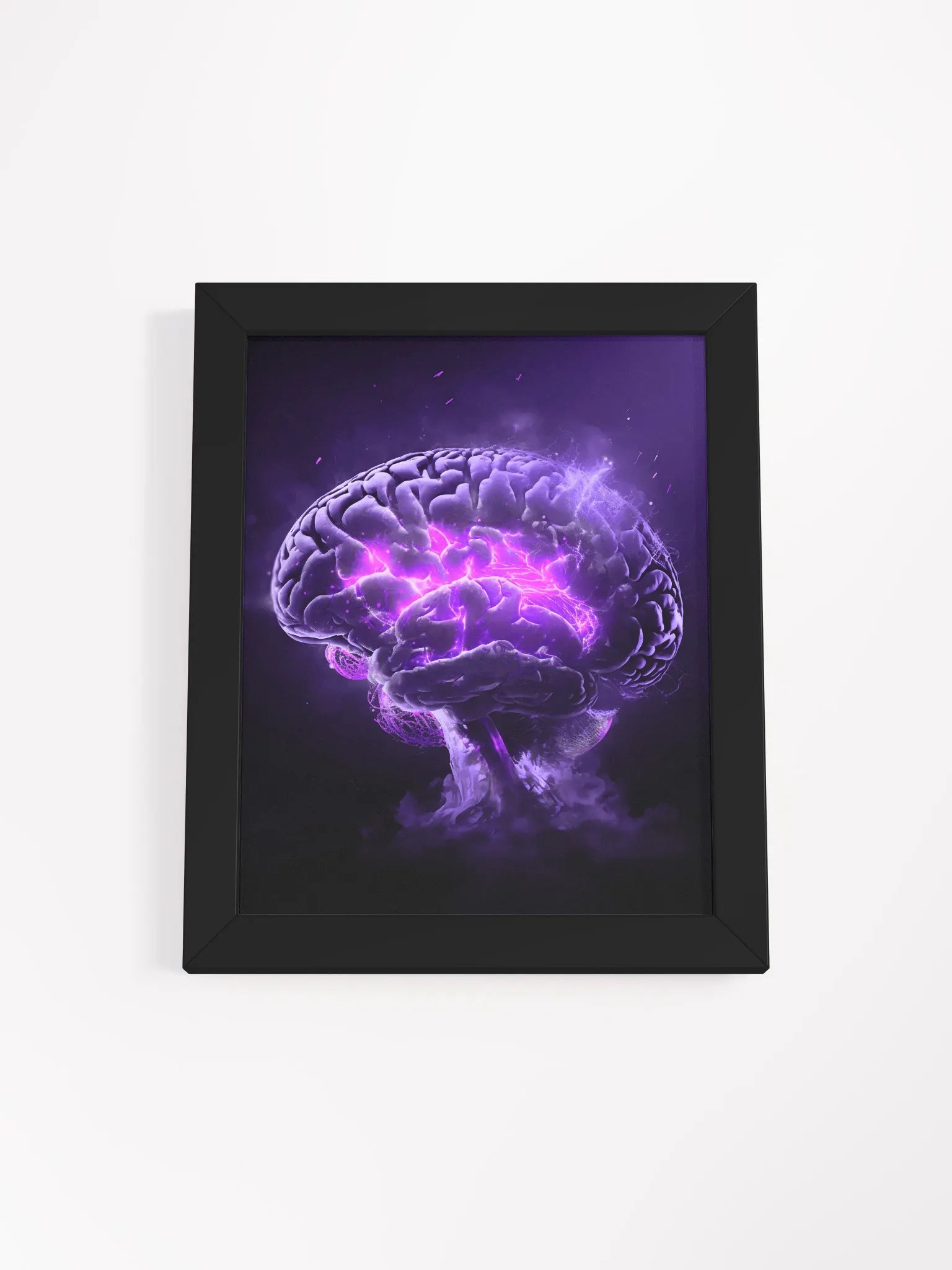 Remyelinating Brain (Framed Matte Print) product image (1)