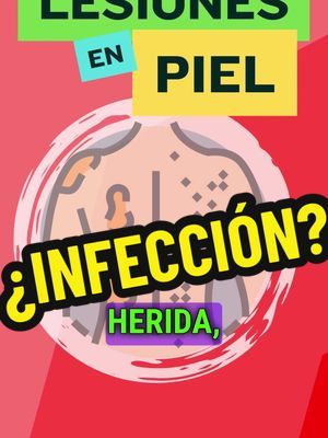 🩺 Lesiones en la Piel: ¿Cuándo Pensar en una Infección? 🌿 Las lesiones en la piel son comunes y pueden ser causadas por diversos factores, como cortes, quemaduras, picaduras de insectos, rozaduras o enfermedades dermatológicas. Sin embargo, algunas de estas lesiones pueden desarrollarse en infecciones si no se tratan adecuadamente. Identificar los signos de infección es fundamental para evitar complicaciones. Aquí te explicamos cómo distinguir cuándo una lesión en la piel podría estar infectada y qué hacer al respecto. 🔹 1. Enrojecimiento e hinchazón 🔴 El enrojecimiento alrededor de una herida es normal, pero si la piel comienza a volverse más roja, hinchada y caliente al tacto, esto puede ser señal de una infección bacteriana. La inflamación es una respuesta del cuerpo para luchar contra la infección. 🔹 2. Pus o secreción 💧 Si la herida comienza a supurar pus (un líquido espeso de color amarillo o verde), es un claro signo de que la lesión está infectada. El pus es producido por el cuerpo como parte de su respuesta inmune a las bacterias. 🔹 3. Dolor intenso 💥 El dolor asociado con una herida puede ser normal, pero si el dolor se intensifica con el tiempo o se vuelve muy localizado, esto podría indicar una infección. Además, el dolor puede ir acompañado de sensibilidad en la zona afectada. 🔹 4. Fiebre 🌡️ La fiebre es una respuesta del cuerpo a las infecciones. Si tienes una lesión en la piel acompañada de fiebre (generalmente superior a 38°C o 100.4°F), es importante buscar atención médica, ya que esto indica que la infección se está propagando. 🔹 5. Mal olor 👃 Un olor desagradable proveniente de una herida también puede ser un signo de infección. El mal olor generalmente proviene del pus que contiene bacterias. 🔹 6. Ampliación de la herida o nuevos síntomas 🚑 Si la herida se vuelve más grande, no cicatriza o presenta nuevos síntomas, como hoyuelos en la piel, úlceras o cicatrización incompleta, esto podría ser señal de una infección crónica o de dificultad para sanar debido a una infección no tratada. 🥗 Consejo: Si tienes una herida en la piel que presenta alguno de estos síntomas, es crucial que consultes a un médico para obtener un diagnóstico adecuado. La antibioterapia o tratamiento local puede ser necesario para evitar que la infección se propague o cause complicaciones graves. #LesionesEnLaPiel #InfecciónDeLaPiel #Salud #Bienestar #CuidadoDeLaPiel#Bienestar #luispacora #dr_luispacora #luispacoracamargo #Prevención 