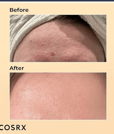 COSRX Advanced Snail 96 Mucin Power Essence 100ml, Skin Repair & Hydrating Serum, Snail Secretion Filtrate 96% & Hyaluronic acid, Korean Skincar product image (6)