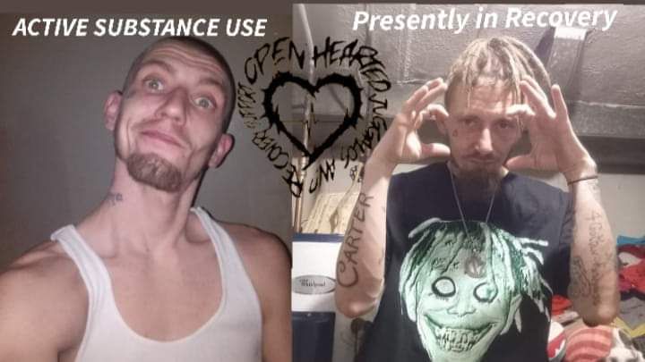 Woody woo before and during recovery product image (1)