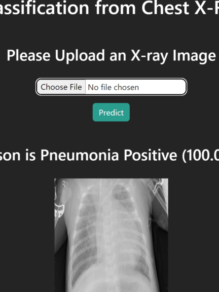 Pneumonia Detection from Chest X-Ray with Flask App Deep Learning Project product image (11)