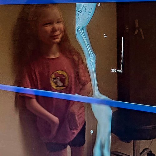 Check out Ana's leg bones! I'll post another (a little more clear) in the stories. We're planning a public live tonight! Be t...