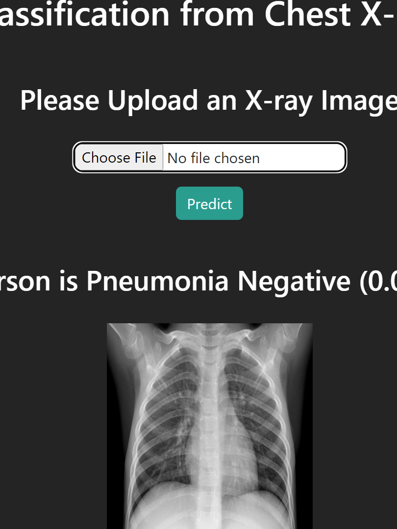 Pneumonia Detection from Chest X-Ray with Flask App Deep Learning Project product image (8)