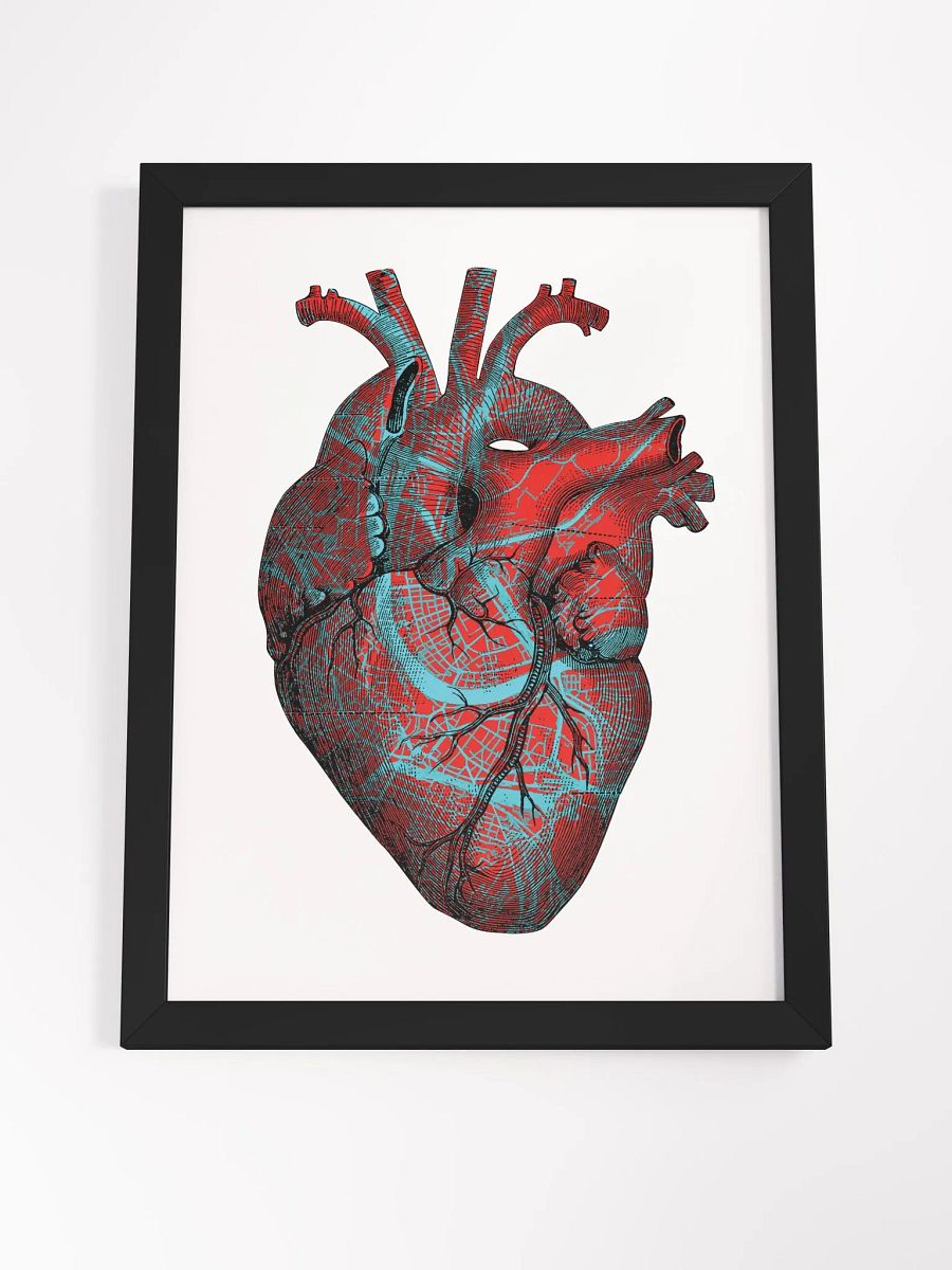 STREETHEART • framed Poster • collectors edition ⭐️⭐️⭐️⭐️⭐️ product image (19)