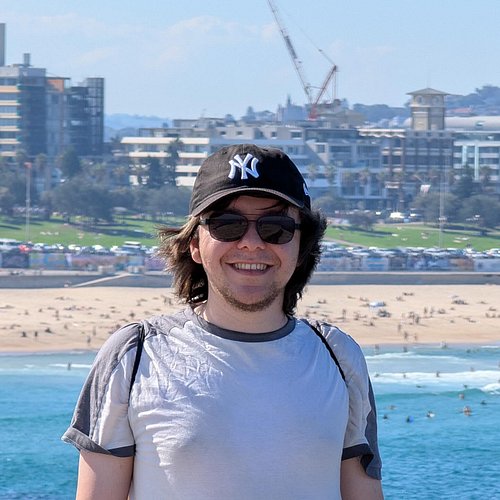 I got extreme sunburn at Bondi Beach but it’s just another souvenir, right?