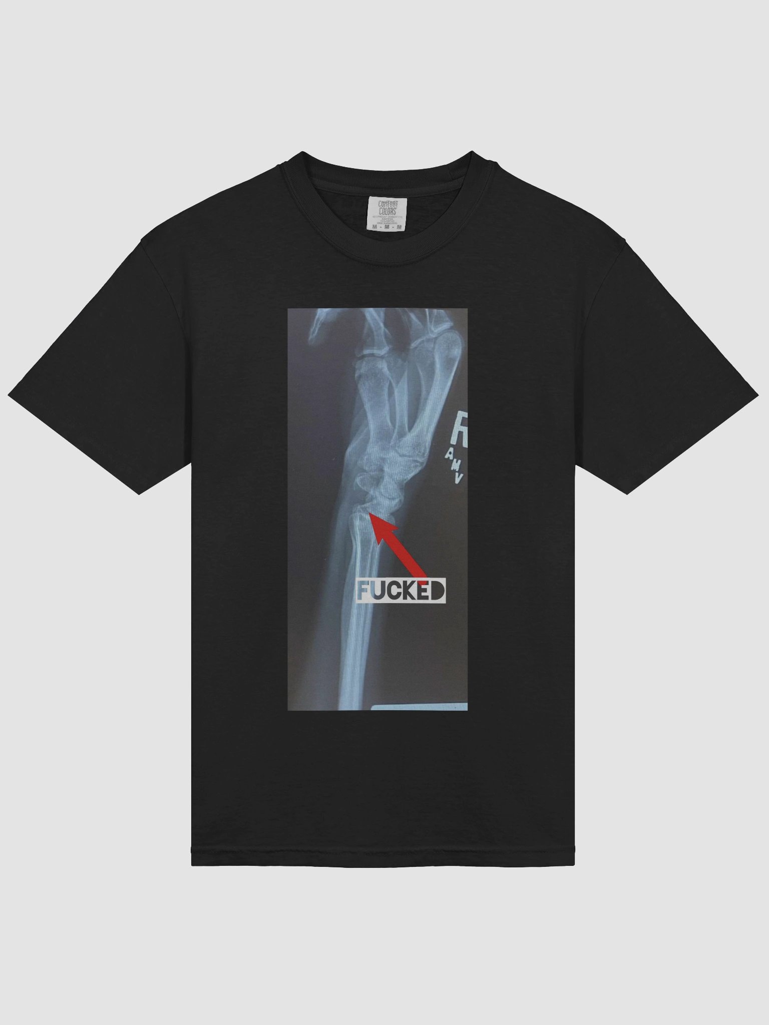 wrist product image (3)