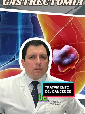 🩺 ¿Qué es la Gastrectomía? ¿Cómo se Maneja el Cáncer del Estómago? 💡 La gastrectomía es una cirugía en la que se extirpa parte o la totalidad del estómago. Esta operación se realiza comúnmente para tratar el cáncer de estómago, aunque también puede llevarse a cabo para tratar úlceras gástricas graves, infecciones o trastornos como la obesidad mórbida. El cáncer de estómago, también conocido como cáncer gástrico, es una de las formas más comunes de cáncer a nivel mundial y afecta a millones de personas cada año. El tratamiento del cáncer de estómago depende de su estadio, ubicación y la salud general del paciente. 🔹 ¿Qué es la Gastrectomía? 🏥 La gastrectomía implica la extirpación parcial o total del estómago. Dependiendo de la extensión del cáncer, el cirujano puede extirpar solo una porción afectada (gastrectomía parcial) o todo el estómago (gastrectomía total). En ambos casos, el objetivo es eliminar las células cancerosas y prevenir su propagación a otras partes del cuerpo. La cirugía puede ir acompañada de quimioterapia o radioterapia para eliminar cualquier célula cancerosa remanente y prevenir recurrencias. 🔹 Manejo del Cáncer de Estómago 🩺 El tratamiento del cáncer de estómago generalmente involucra un enfoque multidisciplinario. Algunas de las opciones de tratamiento incluyen: 	1	Cirugía: La gastrectomía es el tratamiento principal, especialmente en los primeros estadios del cáncer. Puede ir acompañada de la eliminación de los ganglios linfáticos cercanos para asegurar que no haya propagación del cáncer. 	2	Quimioterapia: Después de la cirugía, la quimioterapia puede utilizarse para destruir cualquier célula cancerosa que haya quedado. En algunos casos, la quimioterapia también se utiliza antes de la cirugía para reducir el tamaño del tumor. 	3	Radioterapia: La radioterapia también se utiliza en algunos pacientes, especialmente si el cáncer no se puede extirpar completamente mediante cirugía. Ayuda a reducir el tumor o a aliviar los síntomas. 	4	Inmunoterapia: En algunos casos, se utilizan tratamientos de inmunoterapia para estimular el sistema inmunológico del cuerpo para que ataque las células cancerosas. 🔹 Síntomas del Cáncer de Estómago 🚨 El cáncer de estómago puede ser difícil de detectar en sus primeras etapas, ya que los síntomas suelen ser vagos. Algunos de los síntomas más comunes incluyen: 	•	Dolor abdominal o malestar 	•	Pérdida de apetito y peso inexplicado 	•	Náuseas o vómitos 	•	Dificultad para tragar 	•	Acidez estomacal persistente 	•	Fatiga generalizada 🥗 Consejo: Si experimentas síntomas persistentes relacionados con el estómago, es fundamental consultar a un médico para un diagnóstico temprano. El tratamiento temprano del cáncer de estómago puede mejorar significativamente las posibilidades de éxito en el tratamiento. #Gastrectomía #CáncerDeEstómago #SaludDigestiva #CuidadoDeLaSalud #Prevención #luispacora #dr_luispacora #luispacoracamargo 