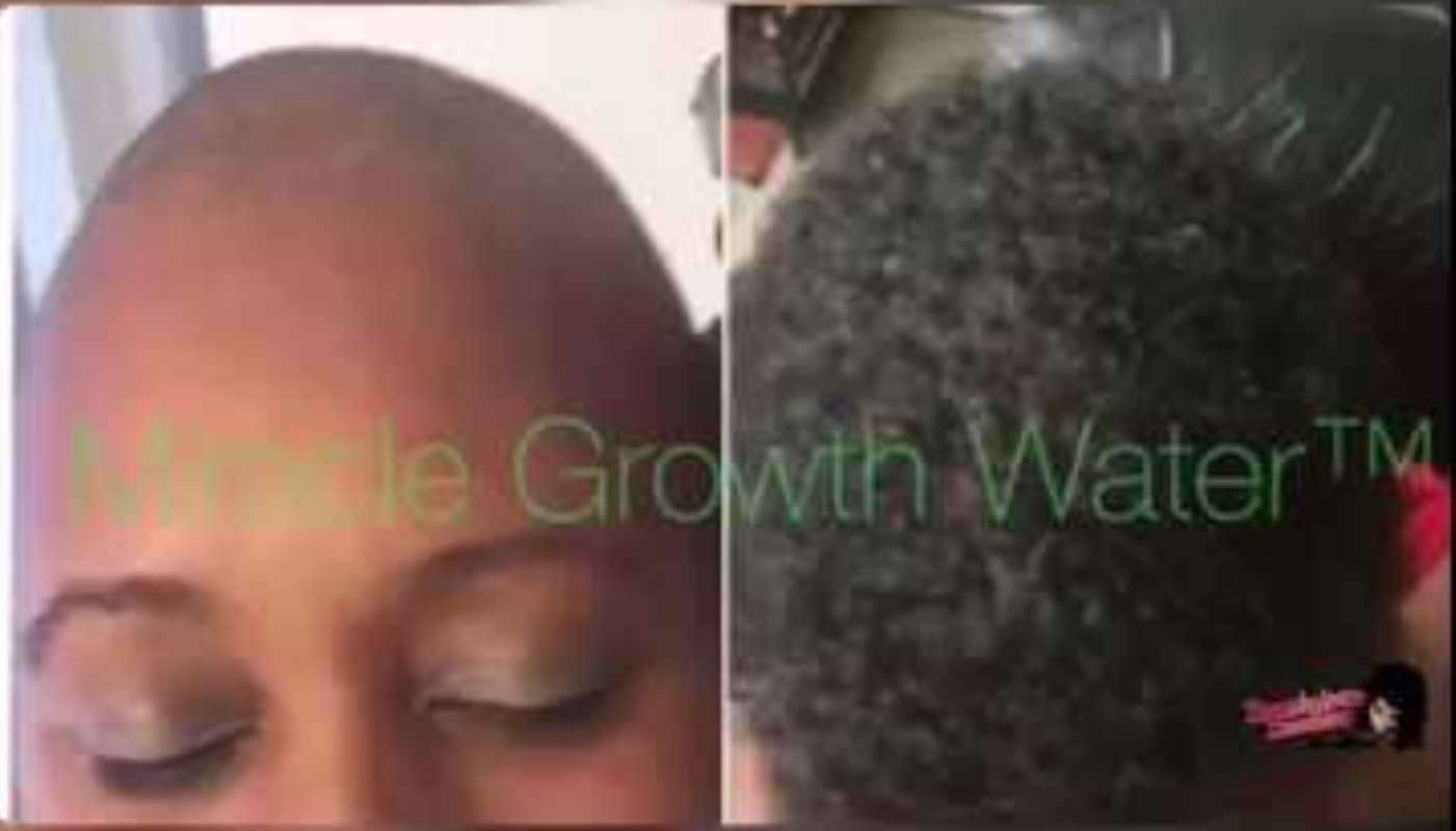 Miracle Growth Water Dry Rice Water Hair Treatment product image (4)