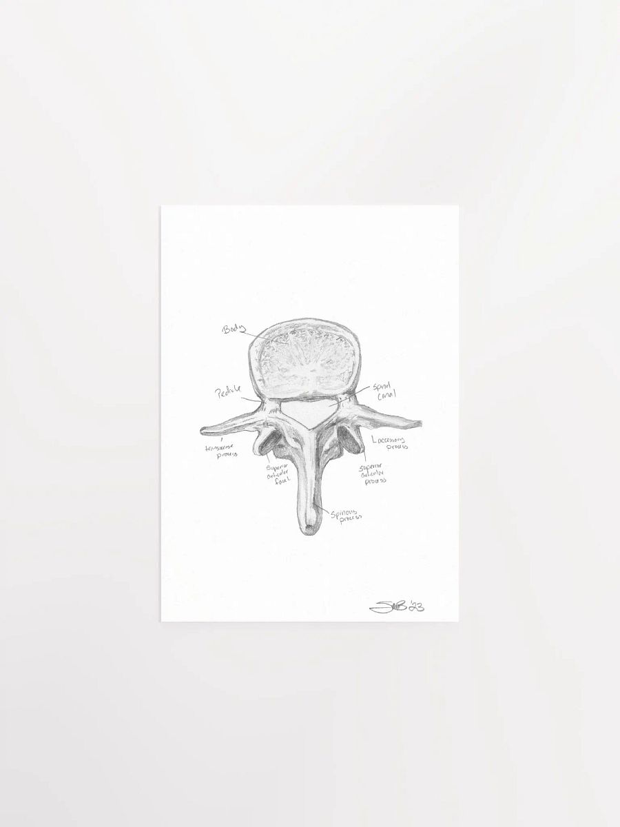 Lumbar Vertebrae Wall Art (Labeled) product image (2)