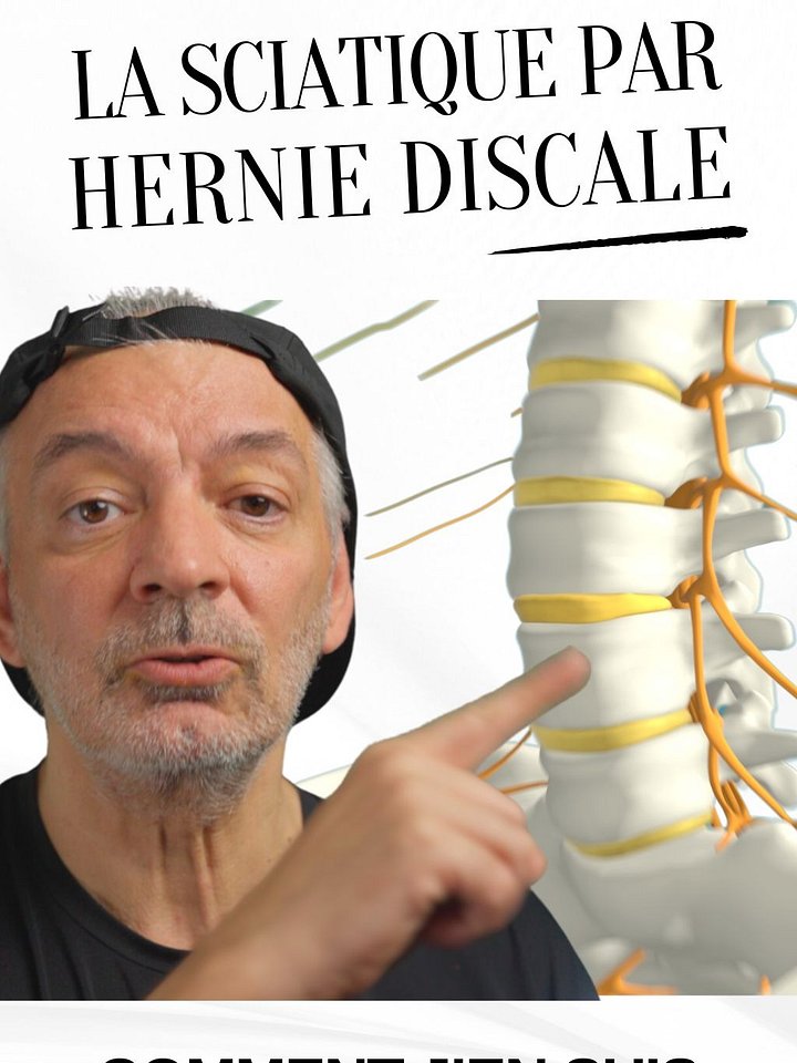 La Sciatique par hernie discale - Comment j'en suis venu à bout product image (1)