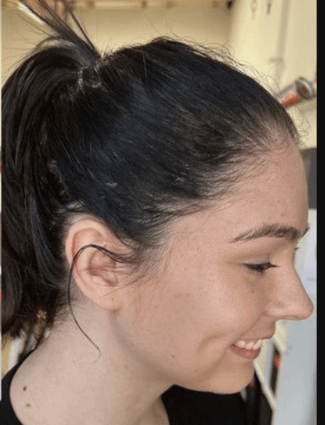 Before image