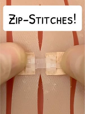 Zip-Stitches! 😲 #1min #funfacts #learnontiktok #suture #suturing #stitches #surgery #surgeonsoftiktok #surgeontok #vet #veterinary #medicine #medicaltiktok #vetsoftiktok #veterinariansoftiktok #vetstudent #vetschool #doctor #doctorsoftiktok #medicalstudent #medicalschool #nurse #nursingstudent #nursingschool #vettechlife #vettechtok #vettechsoftiktok #vettech #lifehack #hack #greysanatomy