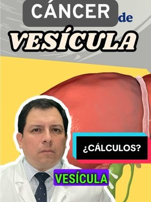 🩺 Cáncer de Vesícula: Síntomas y Factores de Riesgo 🍽️ El cáncer de vesícula biliar es un tipo de cáncer poco frecuente pero grave que se origina en la vesícula biliar, un pequeño órgano ubicado debajo del hígado que almacena la bilis. Aunque este tipo de cáncer es difícil de detectar en sus primeras etapas, conocer sus síntomas y factores de riesgo puede ayudar a la detección temprana y mejorar las posibilidades de tratamiento. Aquí te contamos todo lo que necesitas saber sobre esta enfermedad: 🔹 Síntomas Comunes 🔍 Dolor en la parte superior derecha del abdomen 💥 El dolor abdominal en el área donde se encuentra la vesícula biliar es uno de los síntomas más comunes del cáncer de vesícula. Este dolor puede ser constante o intermitente y puede irradiar hacia la espalda. Náuseas y vómitos 🤢 Las personas con cáncer de vesícula pueden experimentar náuseas y vómitos inexplicables, que a menudo empeoran después de comer. Ictericia 🌿 La ictericia es una coloración amarillenta de la piel y los ojos que ocurre cuando los conductos biliares están bloqueados, lo que impide que la bilis fluya correctamente. Esto puede ser un signo de que el cáncer ha afectado los conductos biliares. Pérdida de peso inexplicada ⚖️ La pérdida de peso sin explicación es otro síntoma común, ya que el cáncer afecta el apetito y el metabolismo. Hinchazón o sensación de plenitud 🍽️ La hinchazón del abdomen o una sensación de plenitud después de comer pequeñas cantidades de alimentos puede ser una señal de que algo no está funcionando correctamente en el sistema digestivo. 🔹 Factores de Riesgo ⚠️ Edad y género ⏳ El cáncer de vesícula es más común en personas mayores de 60 años y afecta con mayor frecuencia a las mujeres que a los hombres. Cálculos biliares 💎 Las personas con cálculos biliares tienen un mayor riesgo de desarrollar cáncer de vesícula, ya que estos pueden irritar la vesícula biliar y aumentar la probabilidad de cáncer. Obesidad 🏋️‍♀️ La obesidad está asociada con un mayor riesgo de desarrollar cáncer de vesícula, ya que afecta la producción de bilis y puede contribuir a la formación de cálculos biliares. Enfermedades inflamatorias crónicas 🩺 Condiciones como la colecistitis crónica (inflamación de la vesícula biliar) aumentan el riesgo de cáncer de vesícula. Historia familiar de cáncer 🧬 Si tienes antecedentes familiares de cáncer de vesícula o cáncer en general, tu riesgo puede ser mayor. 🥗 Consejo: Si experimentas síntomas persistentes o si estás en un grupo de riesgo, es fundamental consultar a un médico para obtener un diagnóstico adecuado. Un tratamiento temprano puede mejorar significativamente las posibilidades de éxito. #CáncerDeVesícula #SaludDigestiva #CuidadoDeLaSalud #Bienestar #Prevención #CapCut #luispacora #luispacoracamargo #dr_luispacora #LIVEIncentiveProgram #LIVERewards #PaidPartnership 