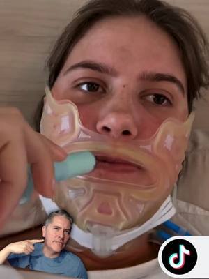 ¡Lo que debes saber tras una cirugía de mandibula! Si planeas realizarte una cirugía de mandíbula, ya sea #cosmética como el contorno mandibular o funcional como una cirugía ortognática, ten en cuenta que el proceso de #recuperación tomará un tiempo y tendrás que llevar una #dieta líquida al inicio que progresará a una dieta blanda. 🎥thaynassoethe #doctor #medicina #cirugia #cirugiaMaxilofacial #maxilofacial #contornoMandibular #cirugiaOrtognatica #cirugiaDeMandibula #recuperacion #progreso #curacion #informacion #sabiasQue #operacion #postOp #reaccion #salud #fyp #foryou #parati #short #reels #mentoplastia #bichectomia