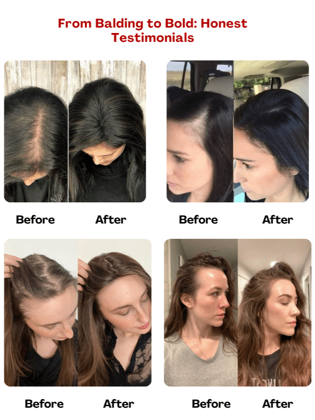 Follicare™ – The Innovative Solution for Healthy Hair & Scalp product image (6)