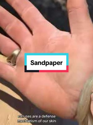 Don't try this at home 😳 #callus #blister #health #ouch