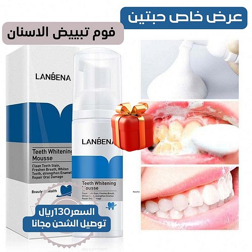 اقوى 💪 عرض مجنون 🔥 على الطلاق 🎉عرض حبتين فوم تبييض الاسنان 😍🎉 فقط ب 130ريال🤩 وتوصيل الشحن مجانا 😎رغوة تبييض الاسنان وتنظيف ال...