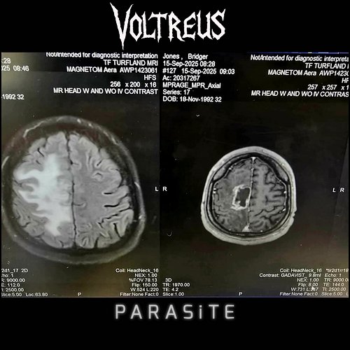 ᴛʜɪꜱ ʜᴀʟʟᴏᴡᴇᴇɴ…
“ᴘᴀʀᴀꜱɪᴛᴇ”
10.31
-
For PARASiTE, Voltreus wanted to dig deep into our Kith & Kin (friends & family). After ma...