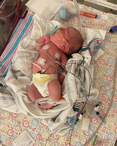 Taking it back to the beginning as we countdown to AMC Awareness Day on June 30th! We’ve been on this journey with Harrison f...
